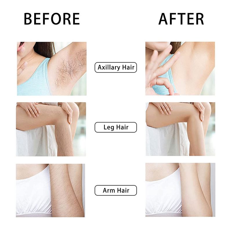UNIQ Crystal Hair Eraser - Epilator with crystal for painless hair removal - Gold - | Fashiongirl