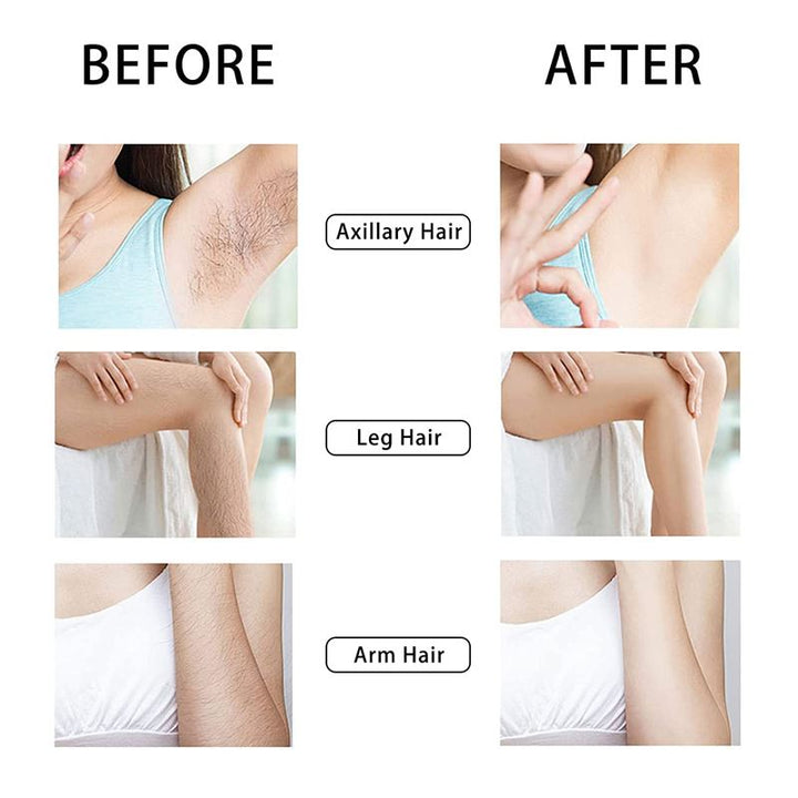 UNIQ Crystal Hair Eraser - Epilator with crystal for painless hair removal - Gold - | Fashiongirl